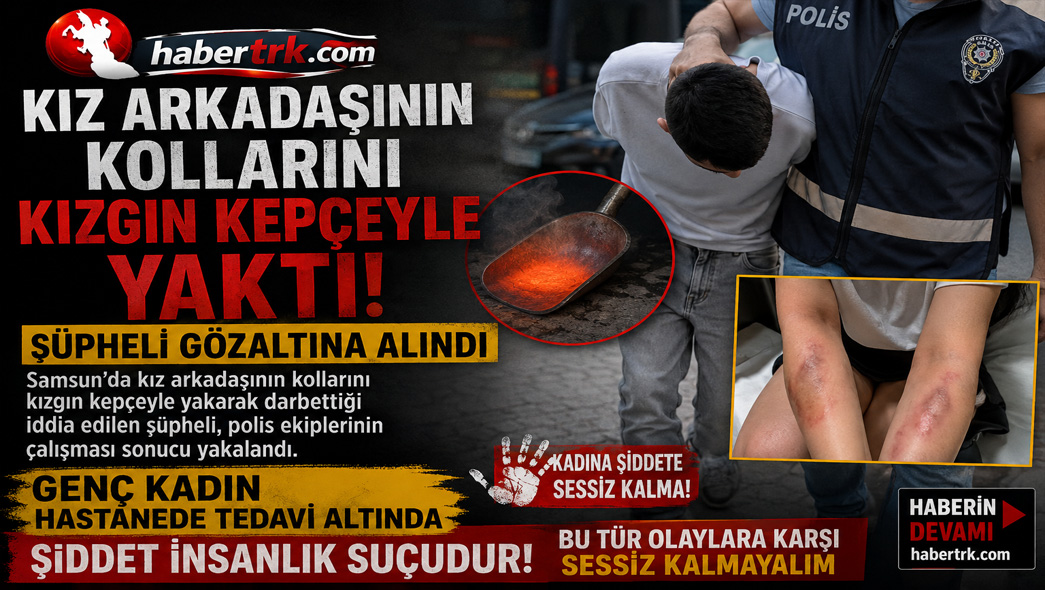 Kız arkadaşının kollarını kızgın kepçeyle yaktı